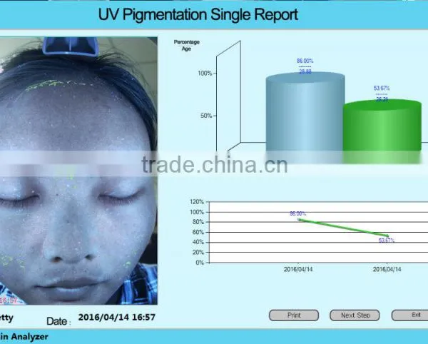 3D Face Scanner/3D Magic Software Magic Mirror Skin Analyzer photo-4