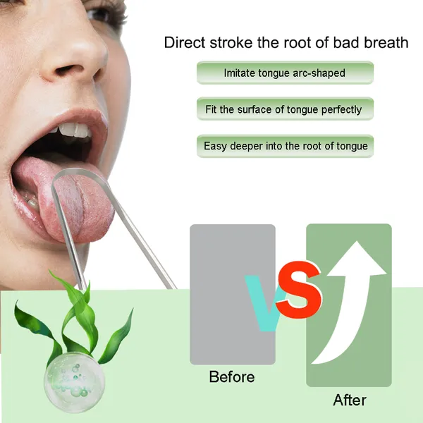Hot Selling Oral Care Tools 304 Stainless Steel Tongue Scraper for Oral Caring photo-3