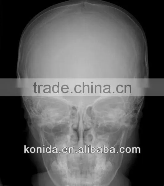 Dental Medical X-ray Film in Medical x Ray Equipment and Accessories