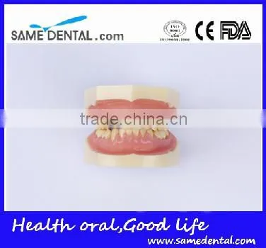 Dental Moderate Periodontal Disease Model Teaching Demonstration photo-3