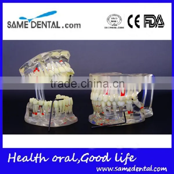 Dental Adult Pathological Dentition Model DEA-48 Teeth Model Teaching Demonstration photo-5