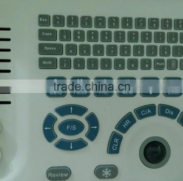 Portable Ultrasonic Diagnostic Devices , Laptop Portable Ultrasound Machine & Ultrasound Scanner photo-2