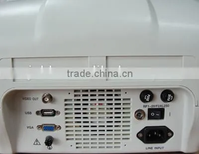 Promotion!!CE Approved Notebook USB Ultrasound Scanner With 3.5Mhz Multi-frequency Convex Probe RUS-6000A photo-4