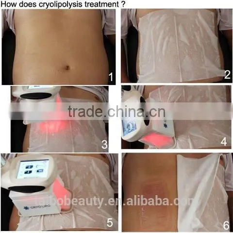 Equipments Producing Cryolipolisis Vacuum Fat Freezing Machines for Weight Loss Slimming photo-6