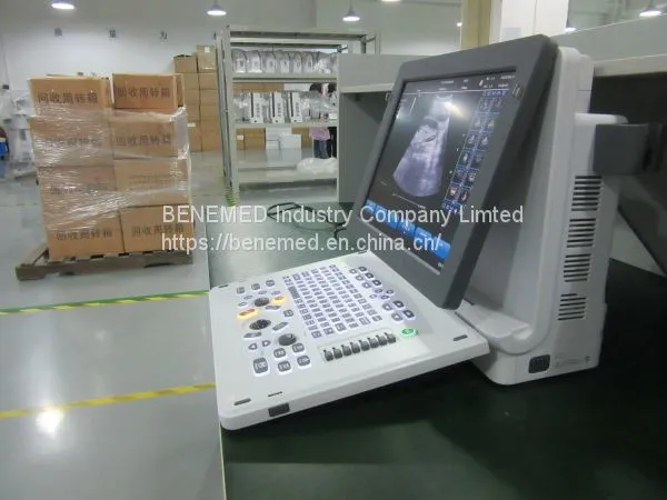 Echo Color Doppler Ultrasound Scanner Bene-5 photo-2