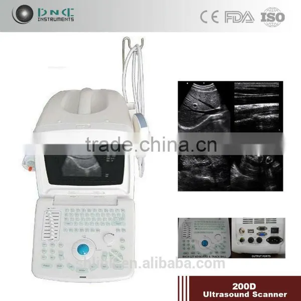 Super LINK Supply Digital Portable Ultrasound Scanner photo-2