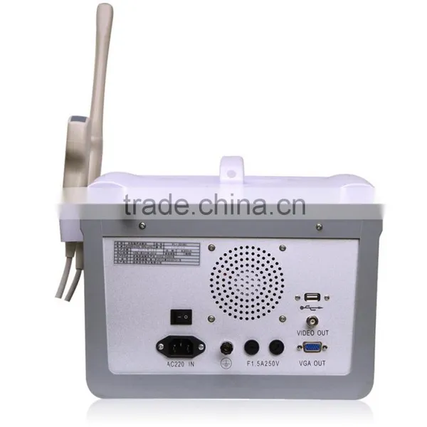 Portable Ultrasound Scanner Price, Hospital Full-digital Laptop 2018CI photo-6