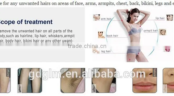 Multifunctional Diode Laser Machine/808nm Diode Laser Adjustable Machine/808nm Diode Laser Hair Removal Machine photo-3