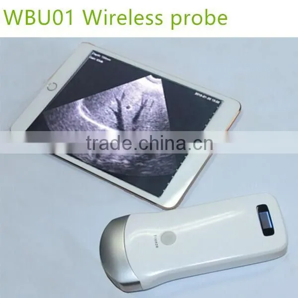 Excellent Portable Wireless Ultrasound Transducers for Sale -WBU01 photo-3