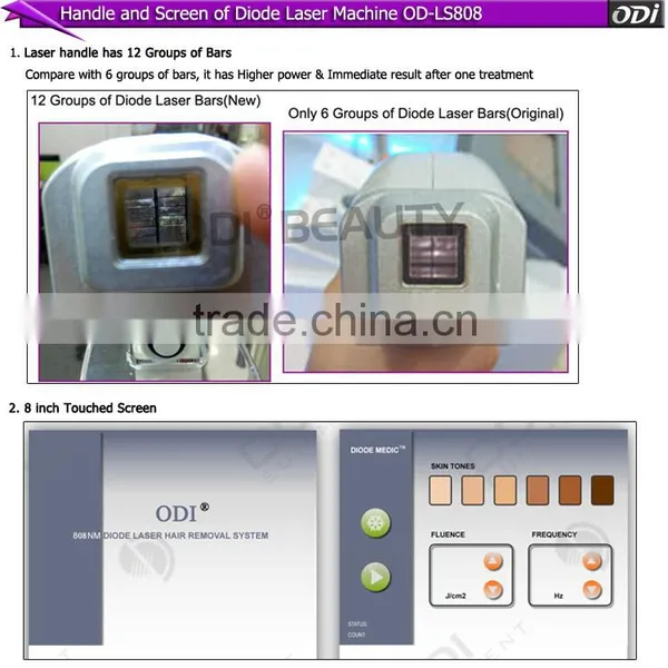 Fast Result Painless Unhairing 808nm Diode Laser Treatment photo-4