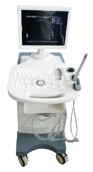 Trolly Build-in Black and White Ultrasound Scanner Diagnostic Equipment photo-3
