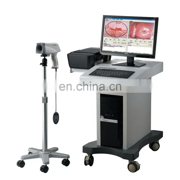 Cheapest Digital Video Colposcope Portable Handheld Video Colposcope photo-3