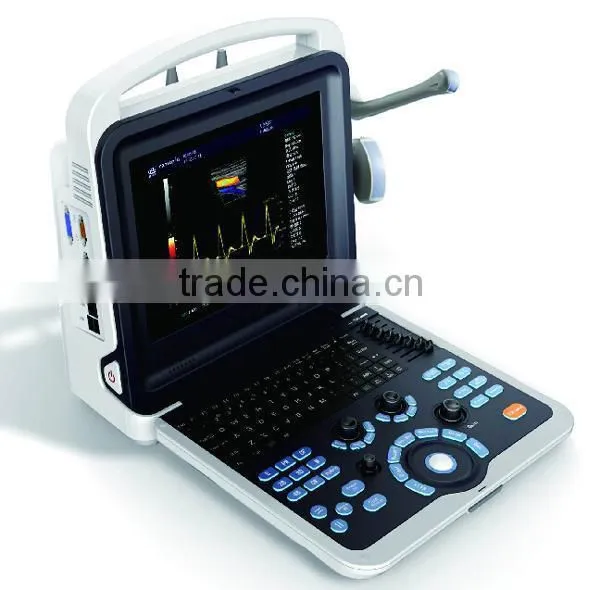 FM-580P Hot Sale 4D Portable Ultrasound Doppler for Sale