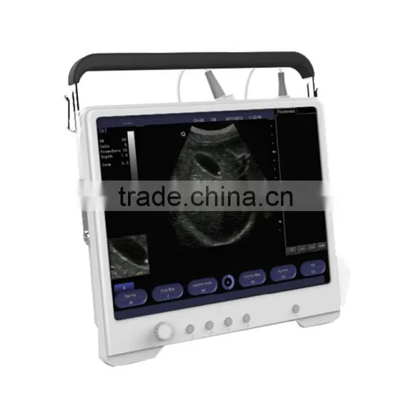 An Excellent Touch Pad B/W Ultrasound System With Clear Image