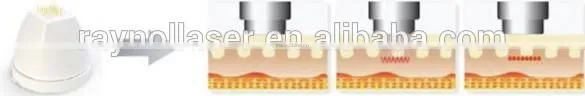 Beauty ROYAL- FR116 Equipment Microneedle Fractional RF Machine photo-6