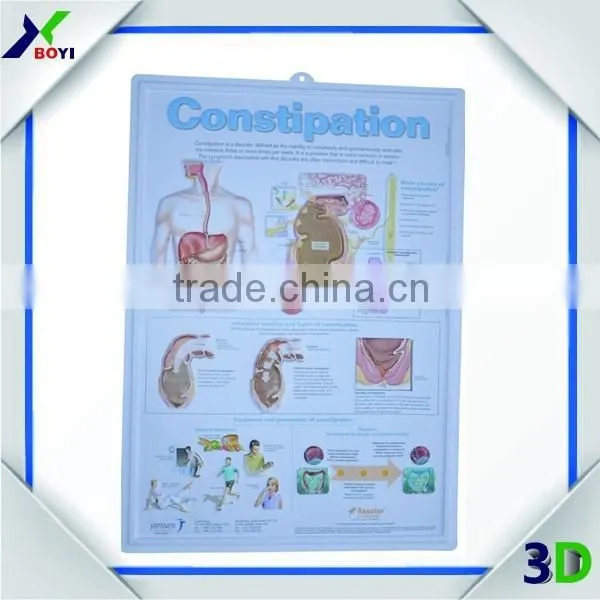 Custom Human Anatomy 3D Embossed Plastic Posters Printing photo-2
