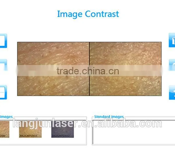 Home, Salons and Clinics Using Portable Skin Tightening Skin Analyzer photo-2