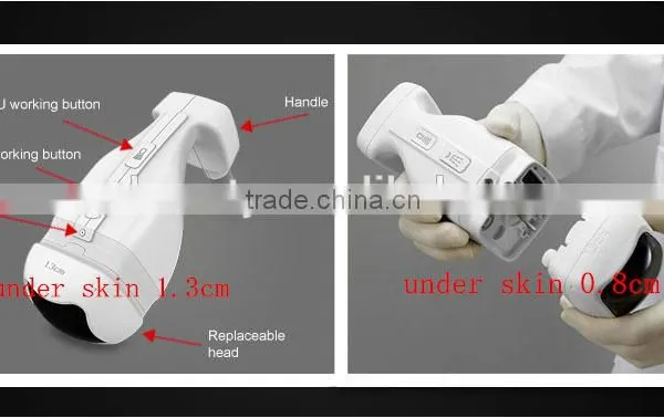 WS-08 2016 Latest Slimming Machine LipoSonix Machine photo-5