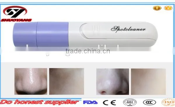 Hot Sale Cheap Blackhead Remover photo-2
