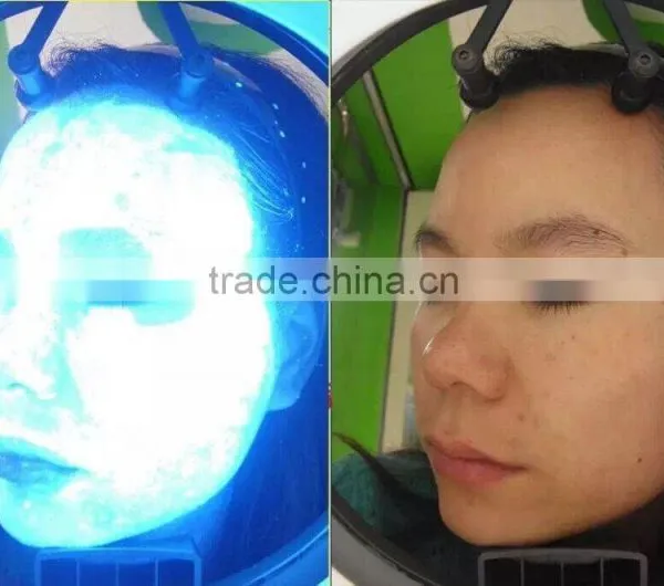 3D Facial Skin Analyzer for Skin Spots Wrinkle Pore Skin Color Analysis P-105B photo-5