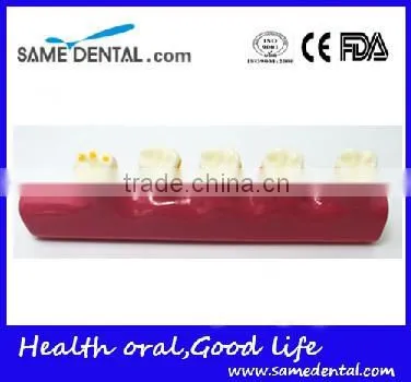 2x Periodontal Disease Classification Models Dental Eduction Assistant No. DEA-20 photo-3
