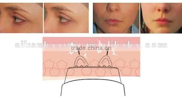 Good Quality Ladies RF Massager Mini Medicines for Lady's rf Skin Tightening Face Lifting Machine for Lady photo-5