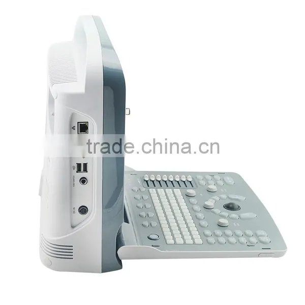 ECO1 100% Good Performance Ultrasound Scanner With 2.5-5.0MHz Convex Probe Carry Bag Foot Switch Sony UP897 Optional photo-3