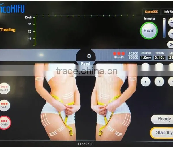 2016 High Intensity Focused Ultrasound Hifu/facelifting Hifu photo-6
