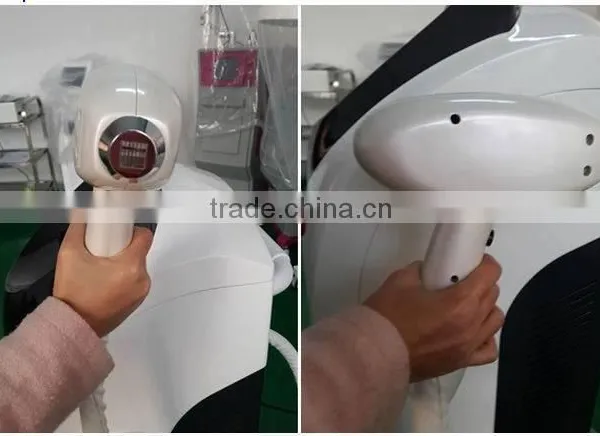 Safe And Effective Portable 808 Diode Laser Treatment For Unwanted Hair Removal From Face By Laser photo-4