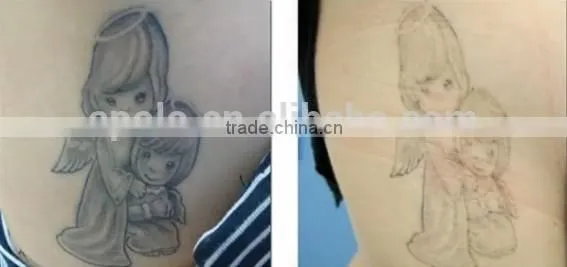 Chinese Apolo ISO CE Approved Beauty Machine Top Tattoo Machine photo-3