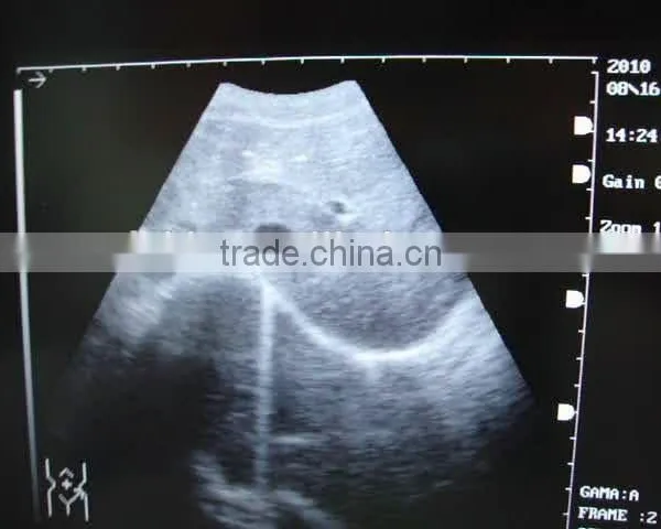 CE Approved Portable Ultrasound Scanner With 3.5Mhz Multi-frequency Convex Probe RUS-9000E photo-4