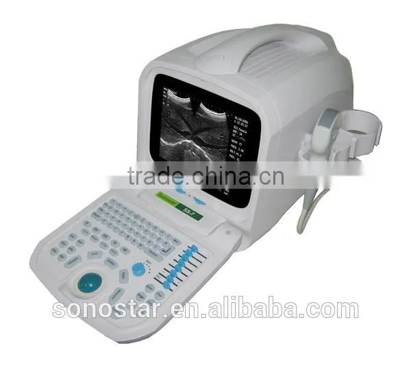 SS-7 Laptop Ultrasound Scanner photo-2