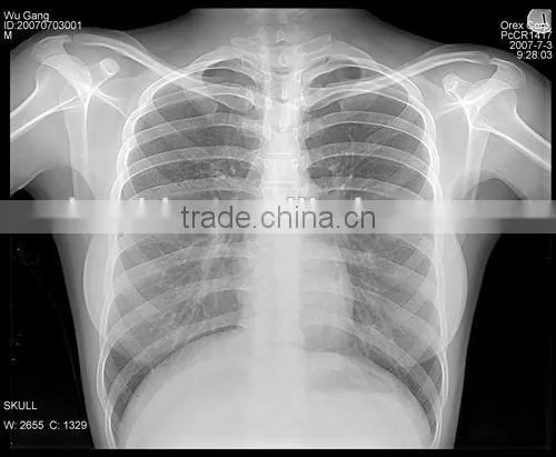 Laser FilmDry Medical Film photo-2