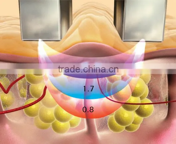 Professional Reaction Face Shaping Radio Frequency Anti-wrinkle RF Machine photo-2