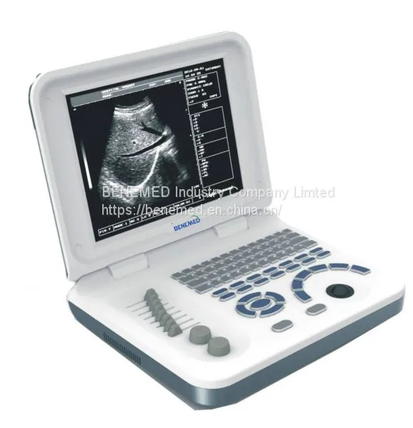 Notebook Type Black and White Ultrasound Scanner Medical Equipment photo-4