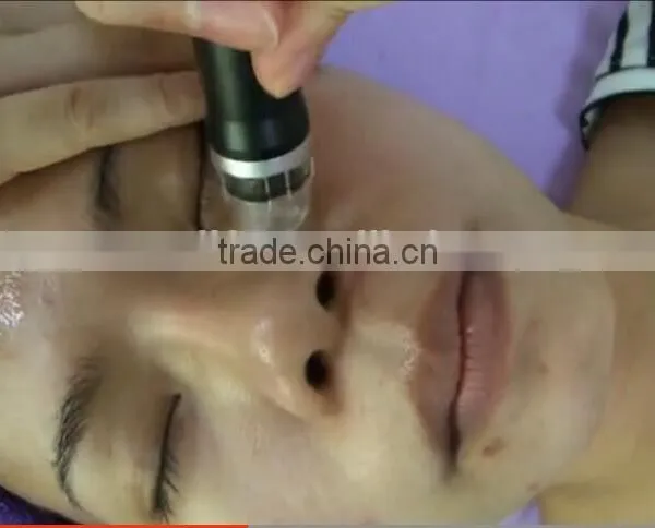 Portable Facial Machine NL-SPA900 --ultrasonic Diamond Dermabrasion+hyperbaric Oxygen Professional Facial Machines+vacuum Facial Water Dermabrasion photo-5