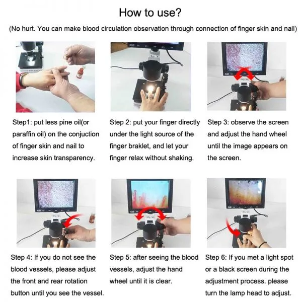 USB Microscope Blood Microcirculation Inspection Zoom Nailfold Capillary Microcirculation Digital Microscope With LCD Screen photo-5