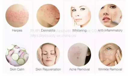 Personal Care PDT LED Skin Rejuvenation Device photo-3