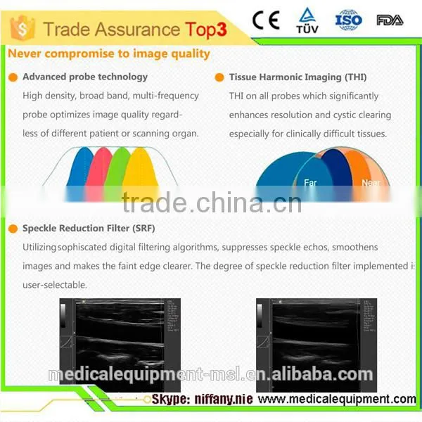3D Color Doppler Ultrasound Machine With Touch Screen With Competitive Price MSLCU22-N photo-3