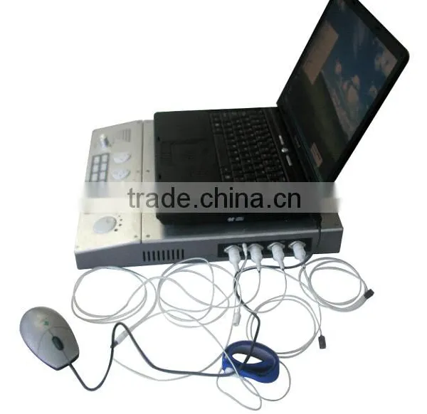 EMG EP Systems Electromyography photo-4