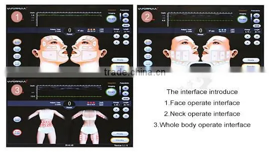 300W Professional HIFU Beauty Machine!!! Body Portable Shapping/Anti-wrinkle HIFU Machine With Teaching Video photo-6