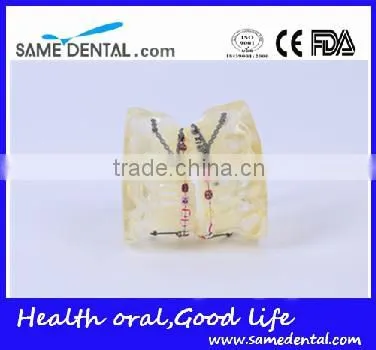 High Quality Dental Transparent Orthodontic Models School Teaching Demonstration photo-3