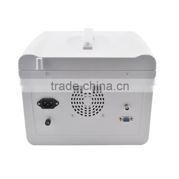 Factory Price!!CE Approved Notebook/Portable Ultrasound Scanner With 3.5Mhz Multi-frequency Convex Probe RUS-6000D photo-3