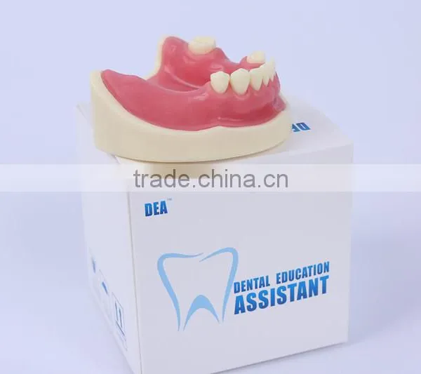 Trade Assurance Hot Dental Implant System CE Approved Dental Implant Model photo-4