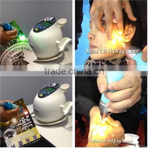 Tattoo Laser Removal Machine Q Switch ND Yag Laser Q Switched Laser Machine Tattoo Removal System Machine Laser Machine For Tattoo Removal photo-3