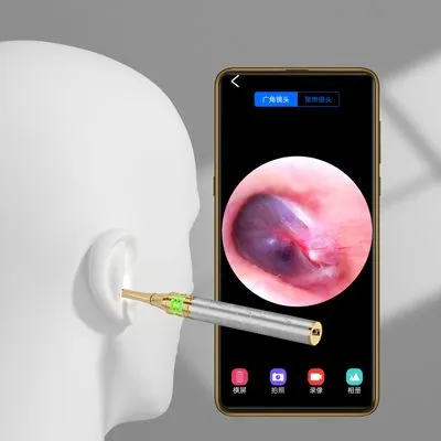 Insteaf of Ear Pick Wooden to Choose WIFI Wireless Smart Visual Ear Cleaning Rod With Ear Otoscope Endoscope Camera photo-3