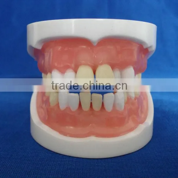 Typodent Dental Jaw Model for Practice Extract Tooth photo-2