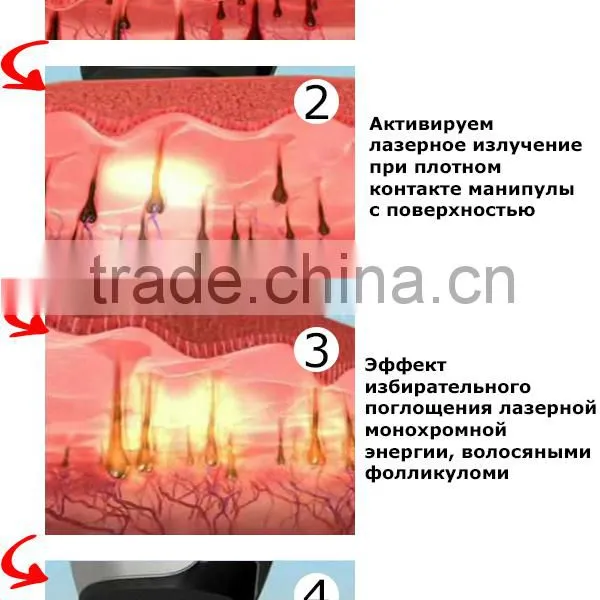 Diode Laser Skin Rejuvenation Equipment 808nm Diode Laser (808) photo-5