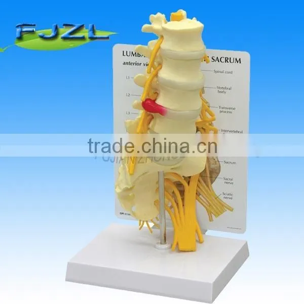 Skeleton Human Model 5-Pc Lumbar Vertebrae With Sacrum