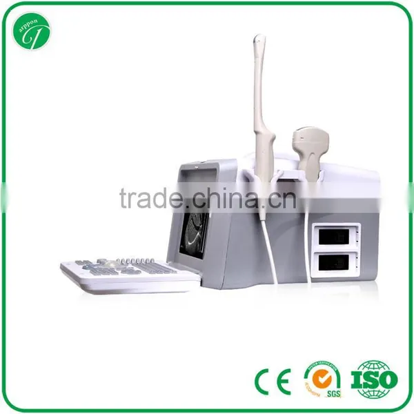 Hospital Professional Portable B Mode Ultrasound Scanner Equipped 3.5Mhz Convex Probe photo-3